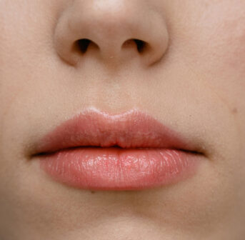 Gerade im Winter brauchen Lippen viel TLC um in Form zu bleiben. Die Tipps dazu gibt es auf sonrisa.
