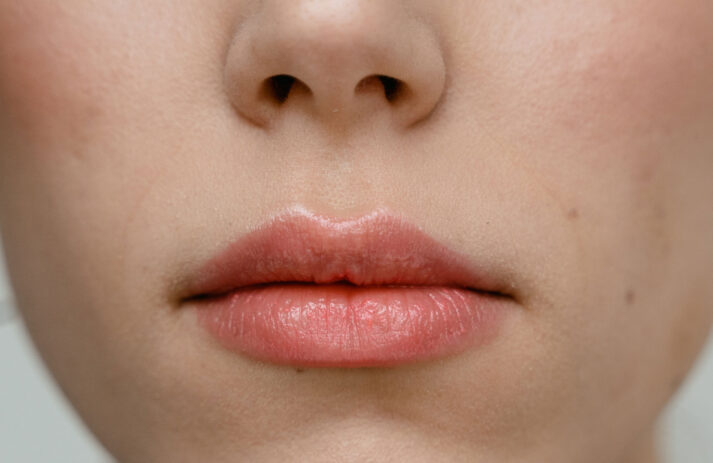Gerade im Winter brauchen Lippen viel TLC um in Form zu bleiben. Die Tipps dazu gibt es auf sonrisa.