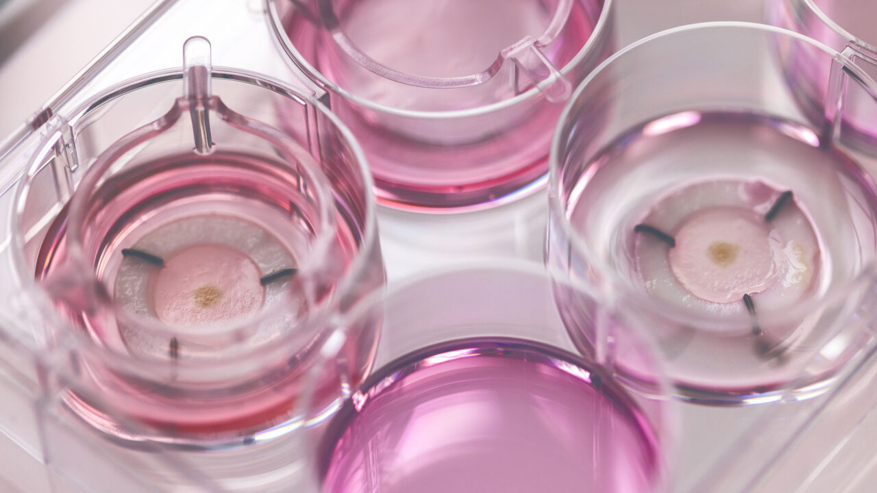 Weil Pigmentflecken uns älter wirken lassen, setzt man bei der Chanel-Forschung auf eine neuartige Innovation, von der man noch viel hören wird.