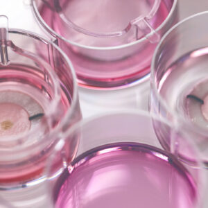 Weil Pigmentflecken uns älter wirken lassen, setzt man bei der Chanel-Forschung auf eine neuartige Innovation, von der man noch viel hören wird.