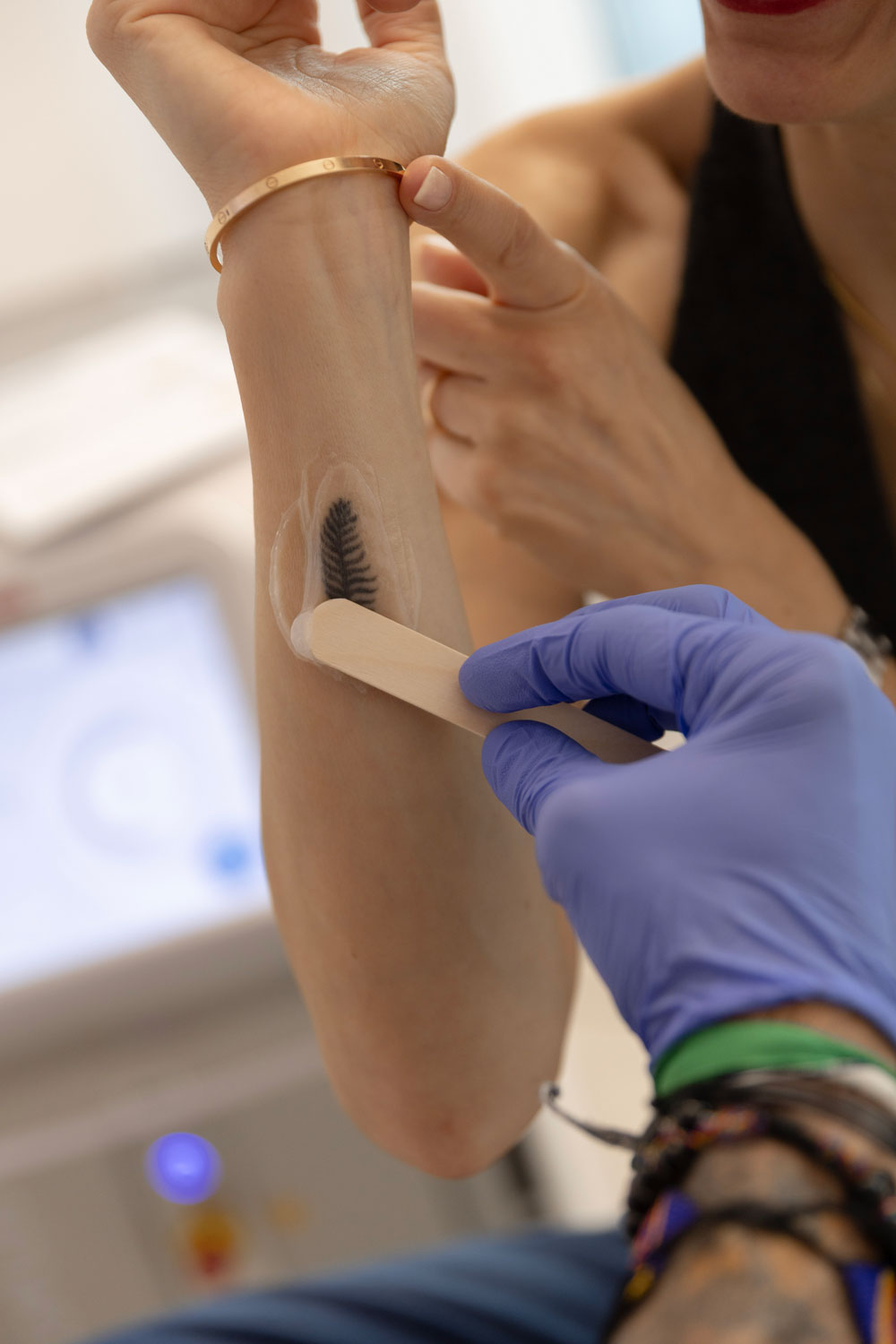 Mein Jugend-Tattoo aus 2000 muss weg. Auf sonrisa erfährst du, wie die Entfernung per Pico-Laser wirklich läuft.