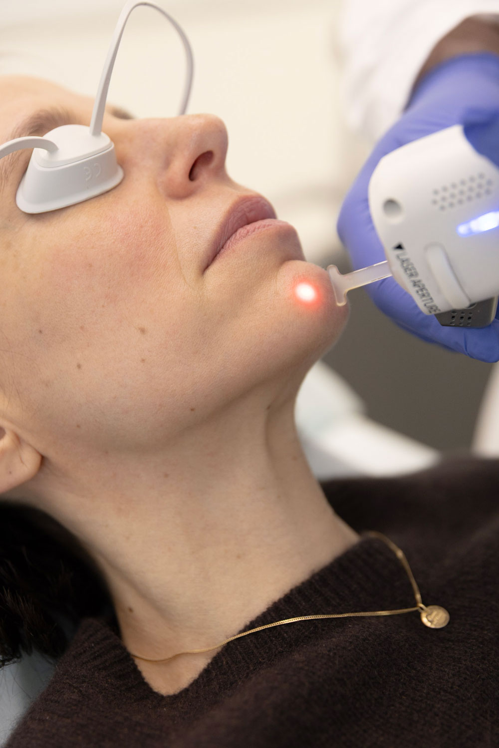 Von ersten Symptomen bis zur Laserbehandlung erklärt dieser Beitrag auf sonrisa alles was man über Rosazea wissen muss.