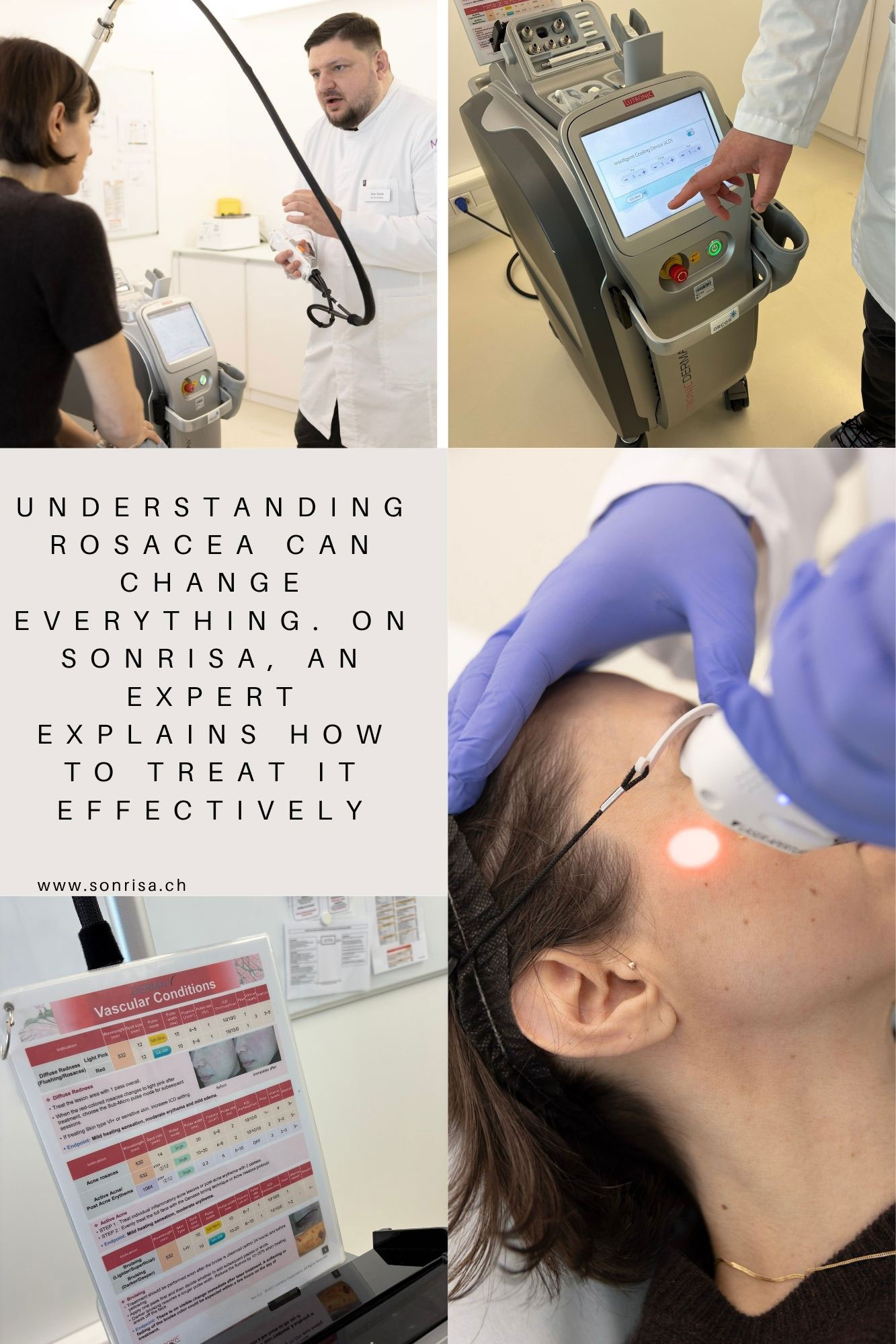 Von ersten Symptomen bis zur Laserbehandlung erklärt dieser Beitrag auf sonrisa alles was man über Rosazea wissen muss.